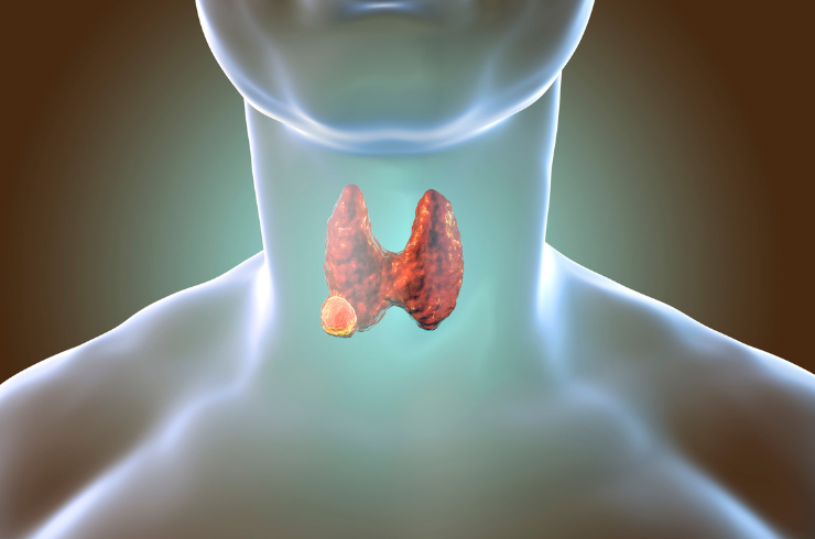 Kidney, Liver, and Thyroid Disorders